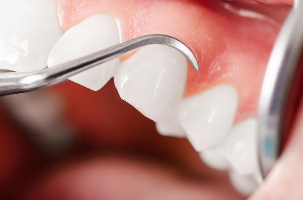 gum treatment